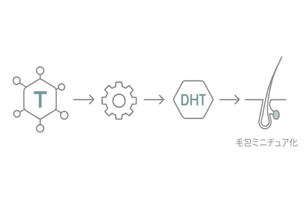 AGAの原因DHT発生と毛包ミニチュア化の流れ（テストステロン→5αリダクターゼ→DHT）メカニズム図