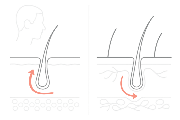 頭皮の硬さと血行の違い|柔らかい頭皮と硬い頭皮の比較イラスト(頭皮マッサージ・はげ予防)