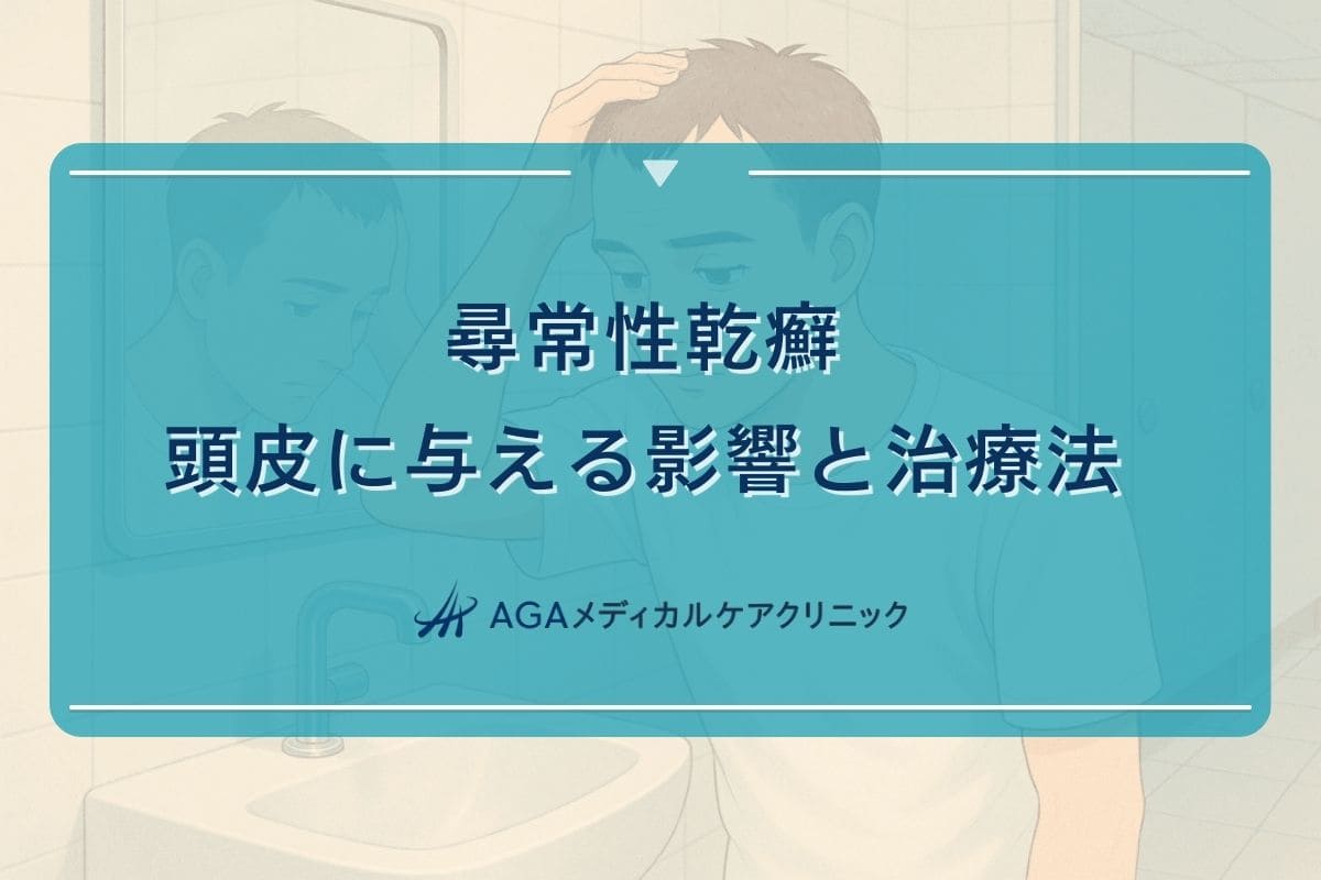 尋常 性 乾癬 頭皮