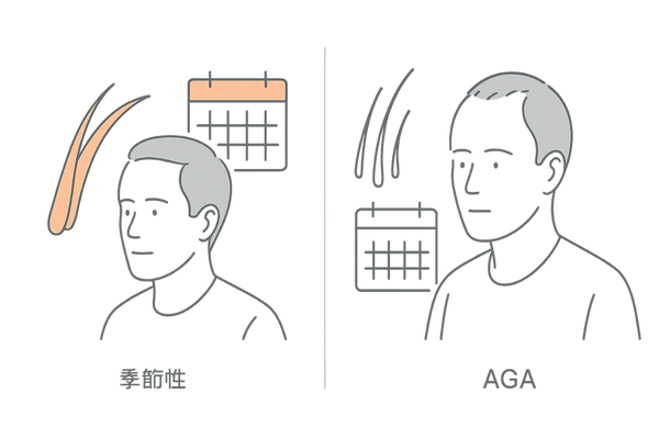 季節性の抜け毛とAGAの違いを視覚で比較(期間・毛の質・進行部位)