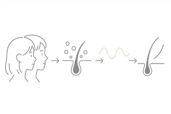 思春期の抜け毛メカニズム|ホルモン変化による一時的な脱毛の流れ