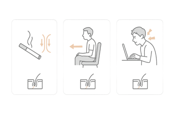 頭頂部薄毛を悪化させる生活習慣｜喫煙・運動不足・長時間デスクワークの比較図