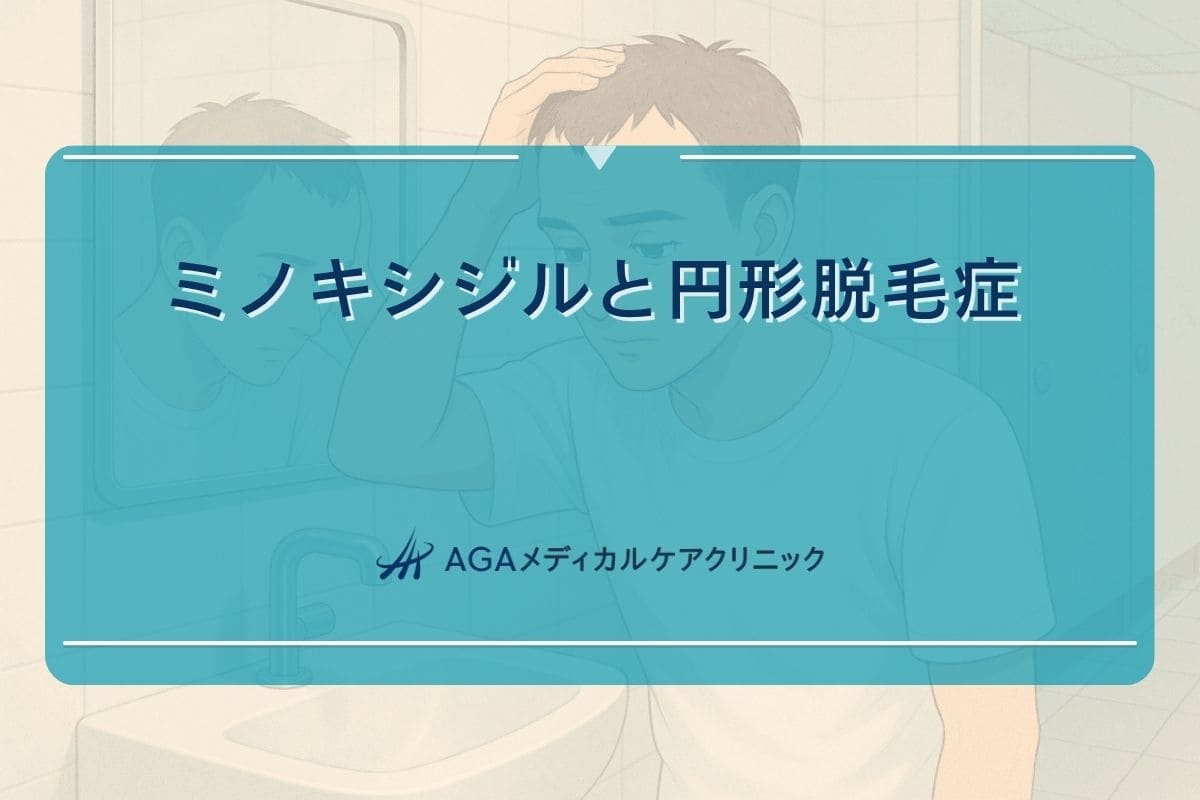 ミノキシジル 円形脱毛症
