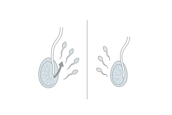 精子形成への影響の左右比較図｜正常な精子産生とテストステロン補充による抑制