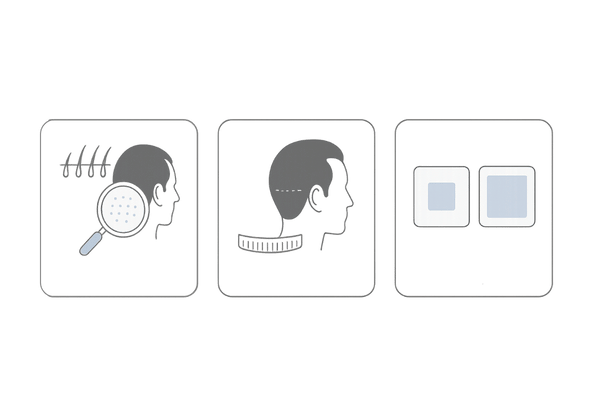 FUEとFUTの違いと適応を示す比較イラスト