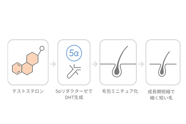 20代の薄毛原因｜AGA進行メカニズム（テストステロン→DHT→毛包ミニチュア化→成長期短縮）