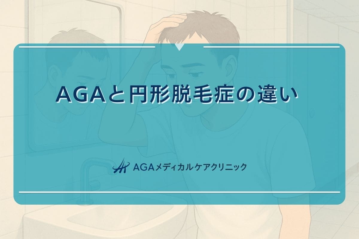 円形脱毛症 aga 違い