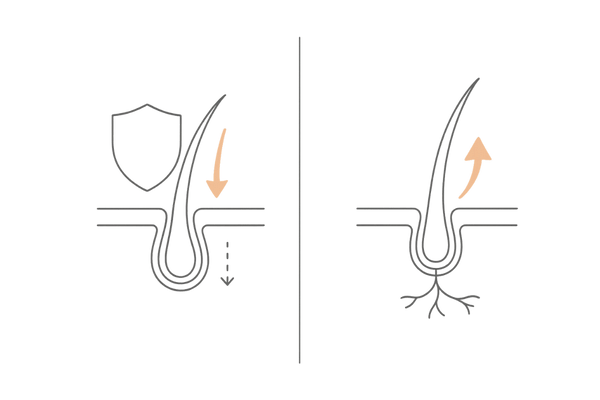 AGA治療薬の役割比較：5αリダクターゼ阻害薬（守り）とミノキシジル（攻め）