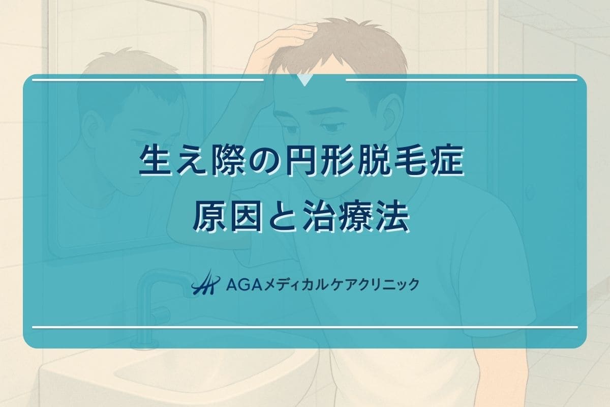 生え際 円形脱毛症