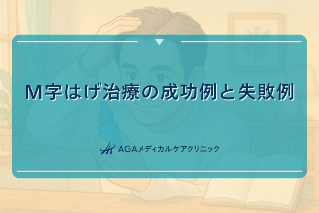 m字はげ 治った, m字はげ 治る