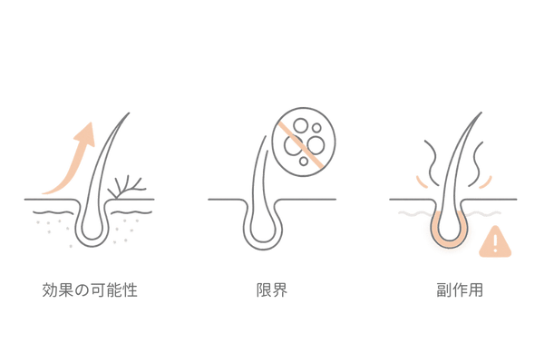 ミノキシジルの効果の可能性と限界・副作用|3カード比較イラスト(円形脱毛症)