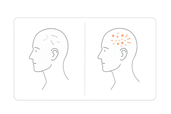 軽い刺激とかぶれ（接触皮膚炎）の違いを左右比較（症状の見分け方）