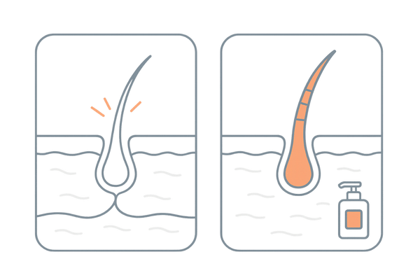 発毛と育毛の違いを直感で示す比較図｜シャンプーは育毛の土台作り