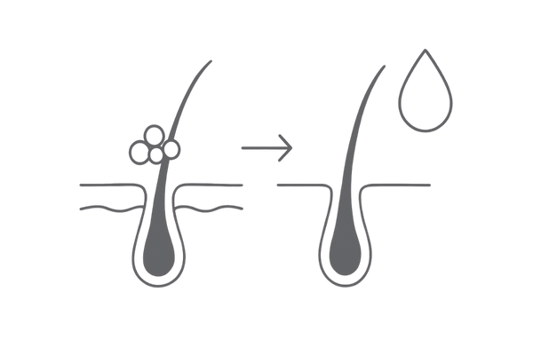 皮脂の過剰分泌と毛穴づまりの模式図｜10代の頭皮トラブルと正しいヘアケア