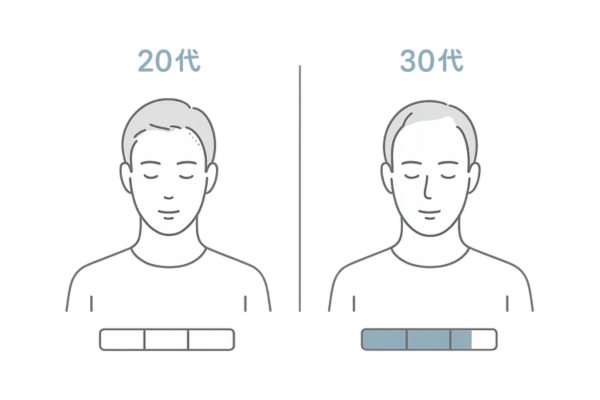 20代と30代のAGA進行パターン比較(単一部位開始vs複数部位同時・進行速度)