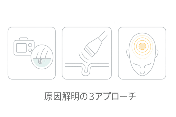 薄毛画像検査の全体像：フォトトリコグラム・超音波・サーモグラフィーの3本柱