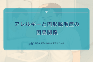 アレルギー 円形脱毛症, アンテベートローション 円形脱毛症