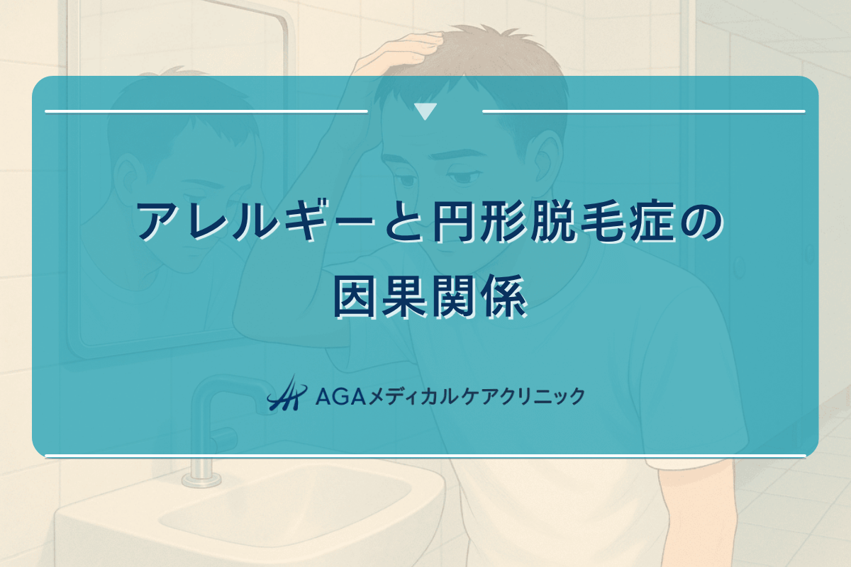 アレルギー 円形脱毛症, アンテベートローション 円形脱毛症
