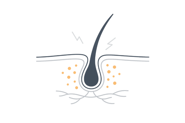 ヒスタミン放出と頭皮環境悪化のイメージ(血管拡張・炎症と成長期短縮)