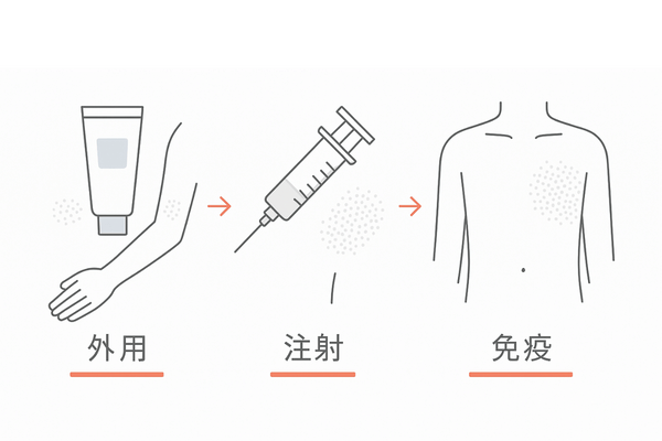 円形脱毛症の皮膚科治療フロー｜ステロイド外用→局所注射→局所免疫療法（重症度に応じた選択）