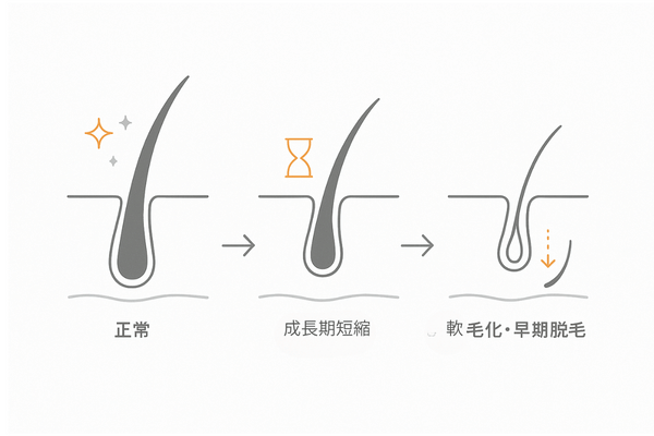 アミノ酸不足による毛周期短縮と軟毛化:髪の変化プロセス図
