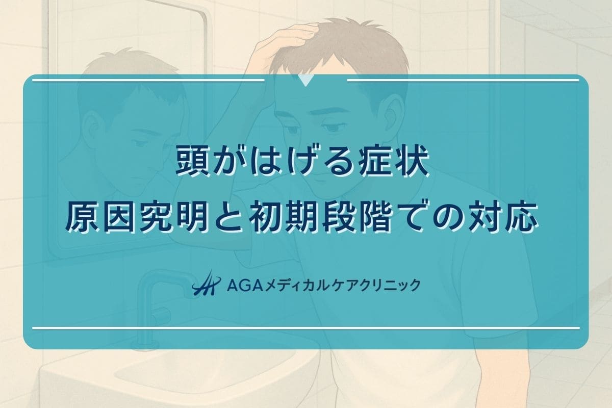 頭がはげる原因