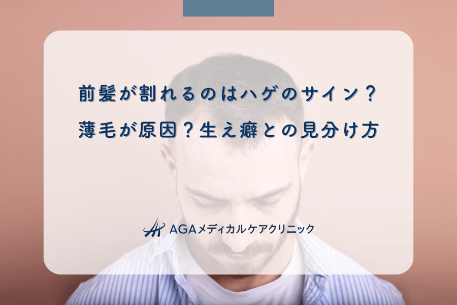 前髪が割れるのはハゲのサイン？薄毛が原因？生え癖との見分け方