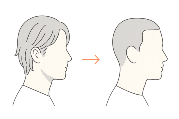 スポーツ刈りで薄毛が目立ちにくくなる理由｜長髪とのコントラスト比較図解