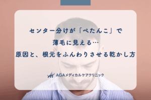 センター分けが「ぺたんこ」で薄毛に見える…原因と、根元をふんわりさせる乾かし方