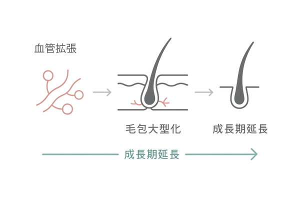 ミノキシジルの作用ポイント｜血管拡張・成長期延長・毛包肥大のイメージ