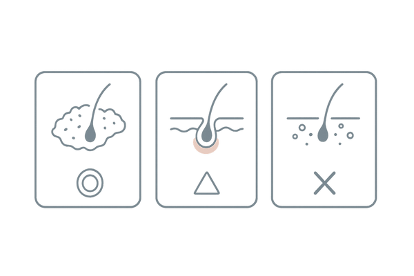 頭皮のかゆみタイプ別・ココナッツオイル適性イメージ（乾燥／軽い炎症／皮脂過多）