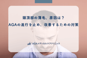 頭頂部の薄毛、原因は？AGAの進行を止め、改善するための対策