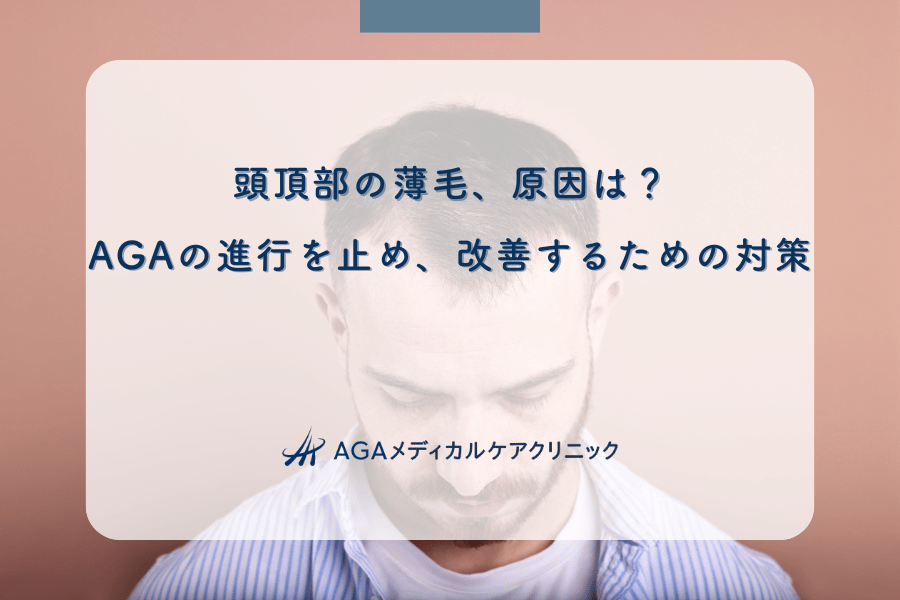 頭頂部の薄毛、原因は？AGAの進行を止め、改善するための対策