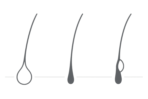 抜け毛の毛根状態の違い（丸い毛根・尖った毛根・白い付着物）｜抜け毛 観察 チェック