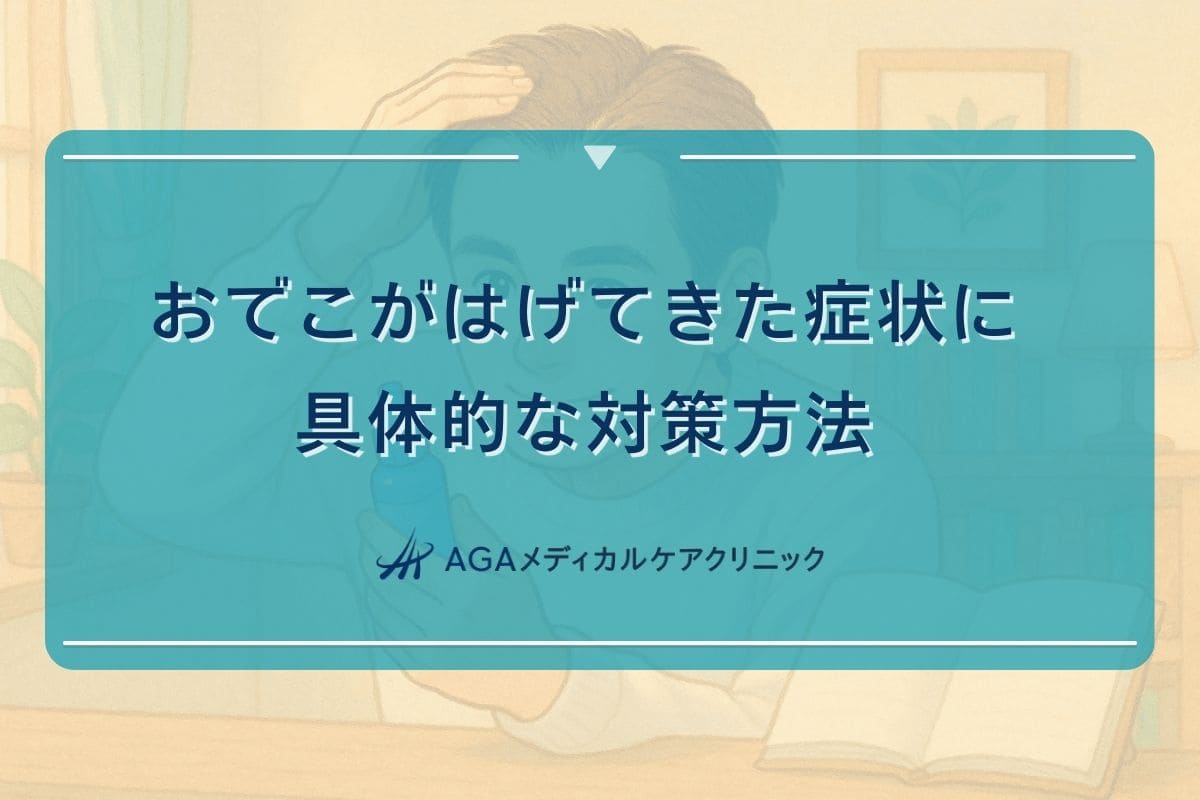 おでこ はげ てきた, おでこ はげ 対策