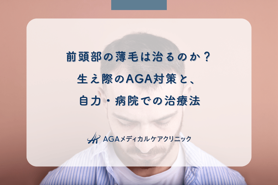 前頭部の薄毛は治るのか？生え際のAGA対策と、自力・病院での治療法
