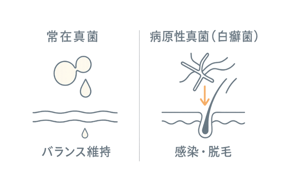 頭皮の常在真菌と病原性真菌の違い