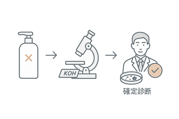 自己判断NGと専門診断の流れ（シャンプー頼み→検査）