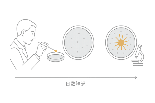 真菌培養検査の原理（コロニー形成と同定のイメージ）