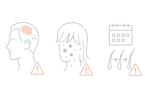 育毛剤を中止すべき危険サインの比較図｜頭皮の赤み・かゆみ・湿疹／フケ増加／長期化する脱毛