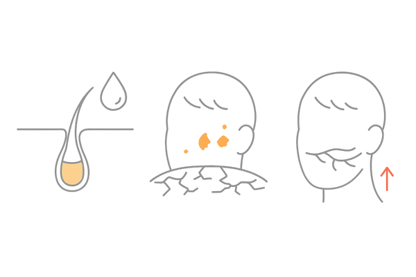 頭皮環境の危険信号3パターン|皮脂詰まり・乾燥フケ・血行不良