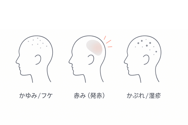 育毛剤(医薬部外品)で起こり得る主な副作用|かゆみ・赤み・かぶれのシンプル図解