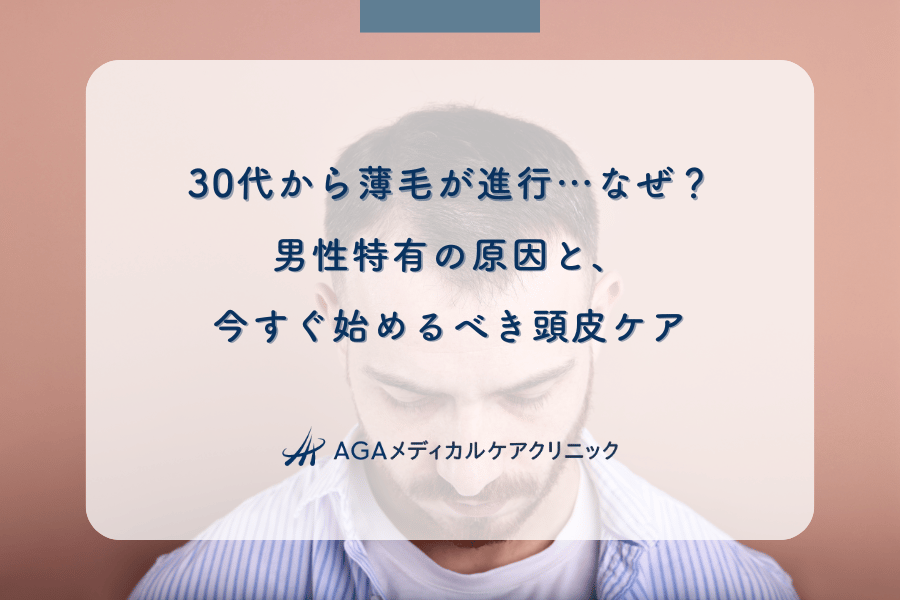 30代から薄毛が進行…なぜ？男性特有の原因と、今すぐ始めるべき頭皮ケア