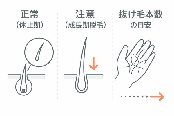 正常な抜け毛と異常な抜け毛の違い｜毛根形状と本数の目安イメージ