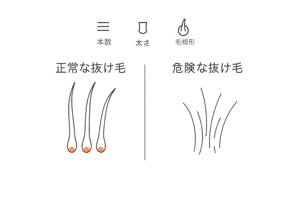 正常な抜け毛と危険な抜け毛の違い｜本数・毛の太さ・毛根形状の比較図