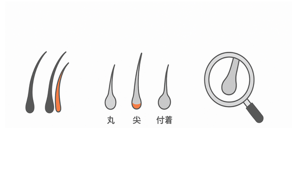 抜け毛の質で分かる危険サイン｜軟毛増加と毛根チェックの視覚ガイド