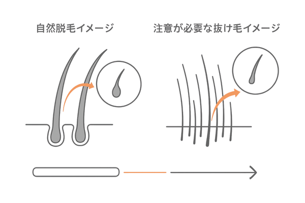 自然脱毛と異常脱毛の見分け方（毛の太さ・毛根形状・本数の比較イメージ）