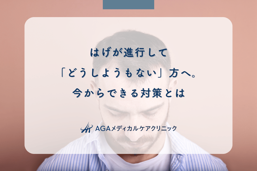 はげが進行して「どうしようもない」方へ。今からできる対策とは