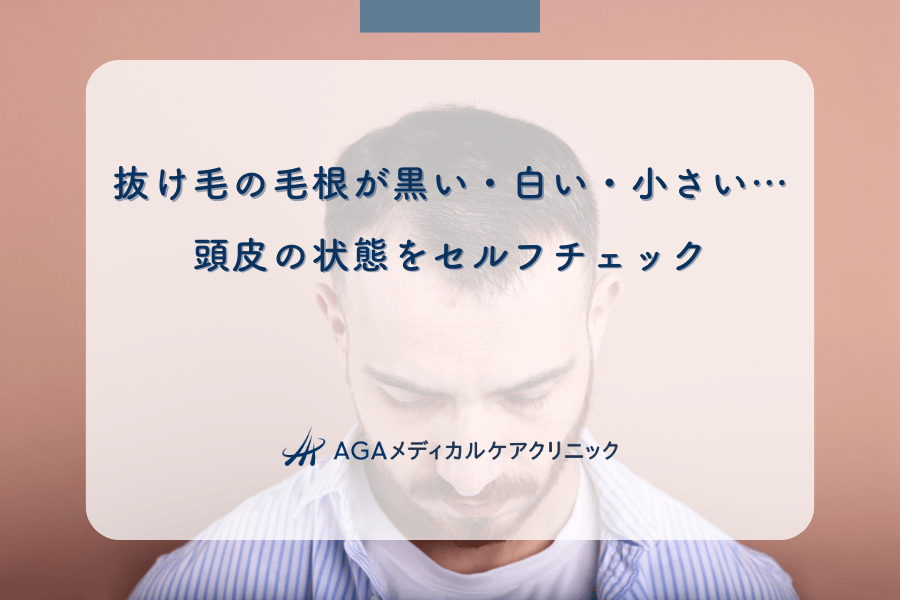 抜け毛の毛根が黒い・白い・小さい…頭皮の状態をセルフチェック