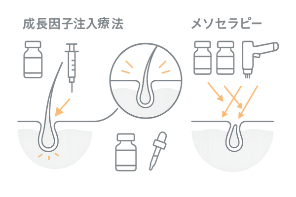 注入治療の比較図｜成長因子注入療法とメソセラピーの違いと毛包への作用
